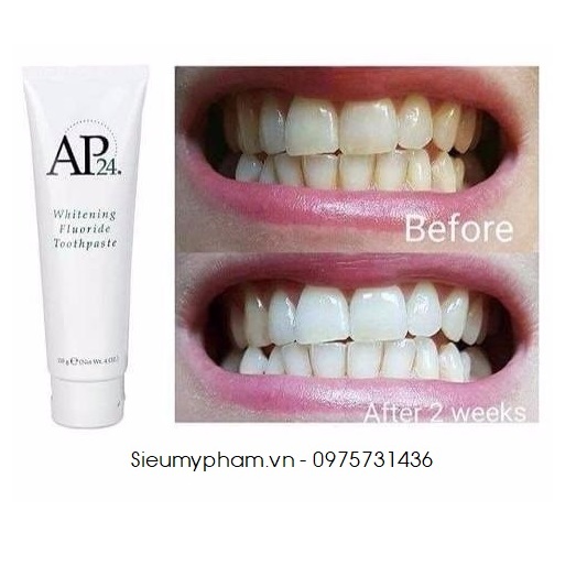Kem trắng răng AP24